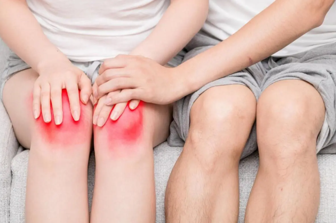 风湿性关节炎的检查项目