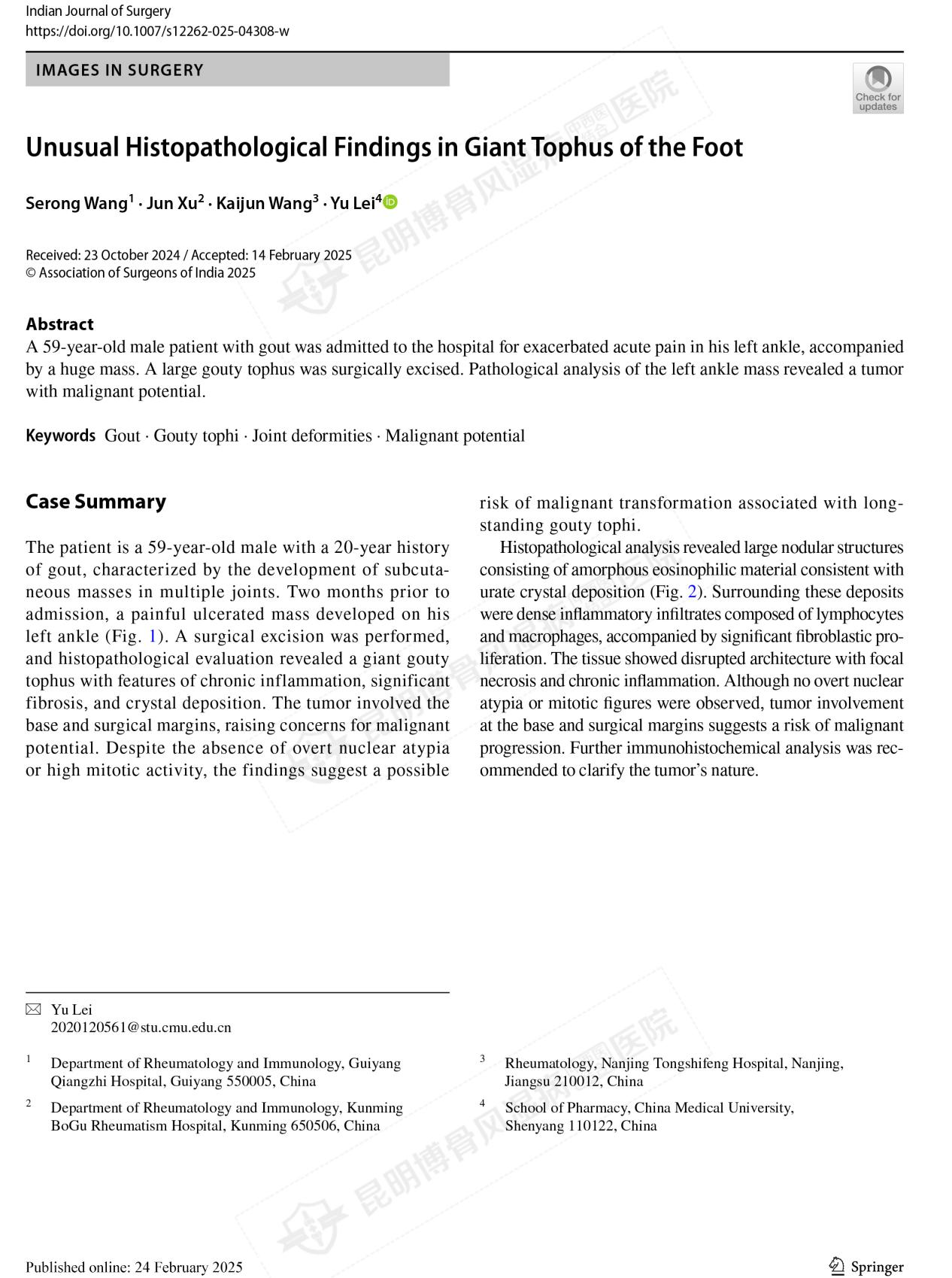 我院研究改写痛风石认知，恶性转化有新发现